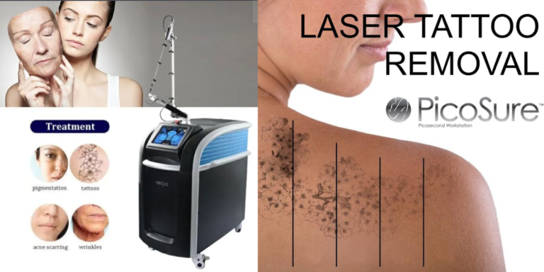 laser tattoo removal treatment at gaurav tattoo studio in gurgaon